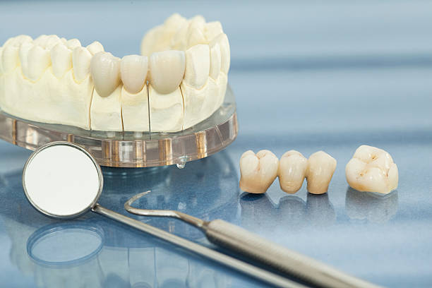 Dental crowns and bridges in Clarenville