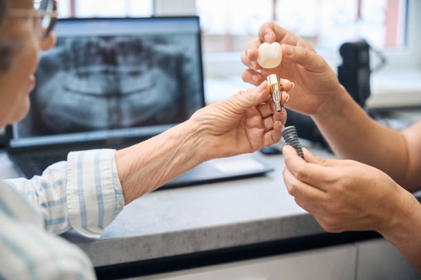 Dental implants in Clarenville