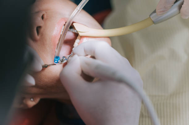 Root canal treatment in Clarenville